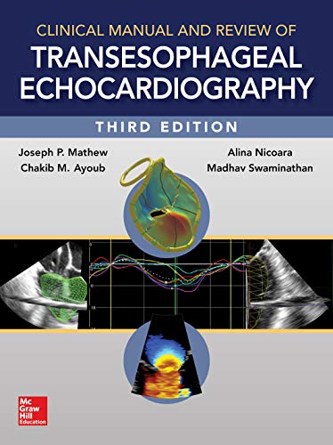 Clinical Manual and Review of Transesophageal Echocardiography, 3/e