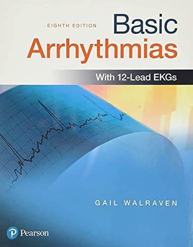 Basic Arrhythmias