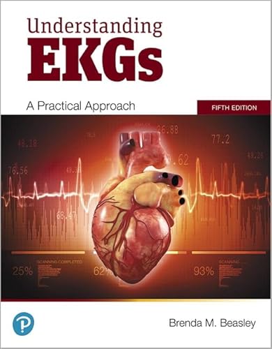 Understanding EKGs: A Practical Approach