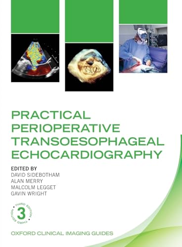 Practical Perioperative Transoesophageal Echocardiography (Oxford Clinical Imaging Guides)