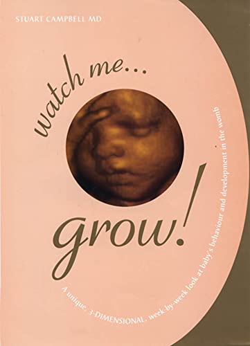 Watch Me Grow: A Unique, 3-Dimensional Week-by-Week Look at Your Baby's Behavior and Development in the Womb