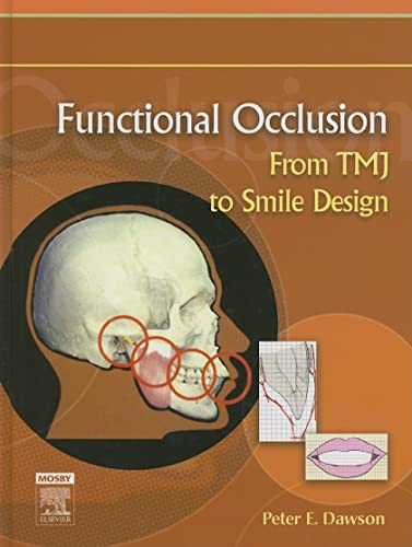 Functional Occlusion