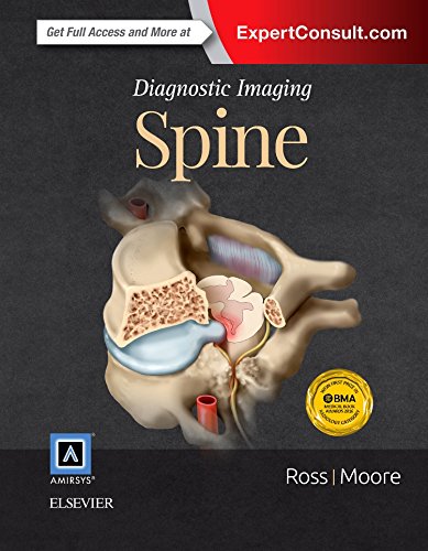 Diagnostic Imaging: Spine