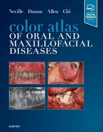 Color Atlas of Oral and Maxillofacial Diseases