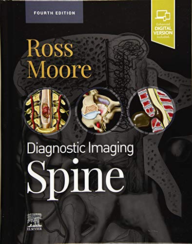 Diagnostic Imaging: Spine