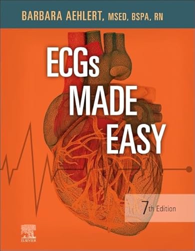 ECGs Made Easy