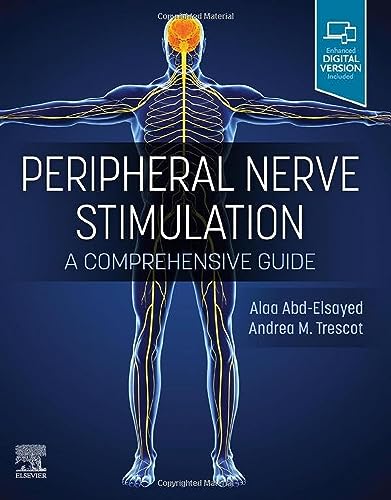 Peripheral Nerve Stimulation: A Comprehensive Guide