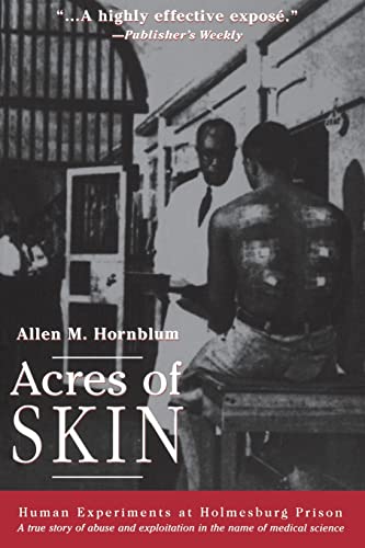 Acres of Skin: Human Experiments at Holmesburg Prison