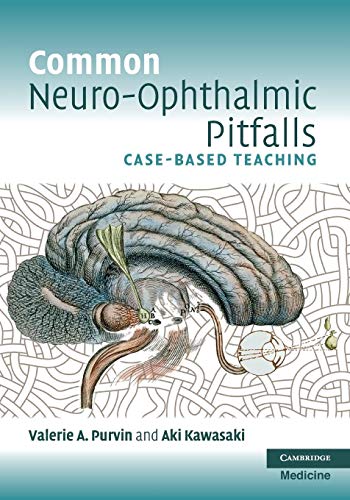 Common Neuro-Ophthalmic Pitfalls: Case-Based Teaching (Cambridge Medicine (Paperback))