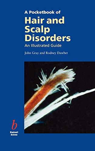 A Pocketbook of Hair and Scalp Disorders: An Illustrated Guide