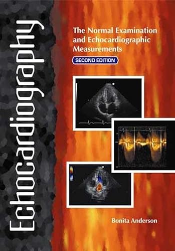 Echocardiography: The Normal Examination and Echocardiographic Measurements