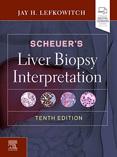 Scheuer's Liver Biopsy Interpretation