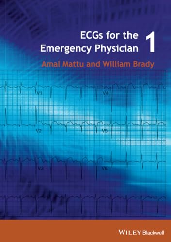 ECG's for the Emergency Physician 1