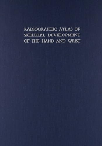 Radiographic Atlas of Skeletal Development of the Hand and Wrist