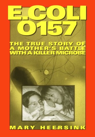 E.coli 0157
