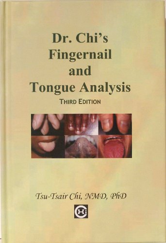 Dr. Chi's Fingernail and Tongue Analysis