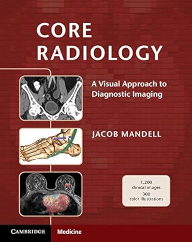 Core Radiology: A Visual Approach to Diagnostic Imaging