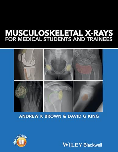 Musculoskeletal X-Rays for Medical Students and Trainees