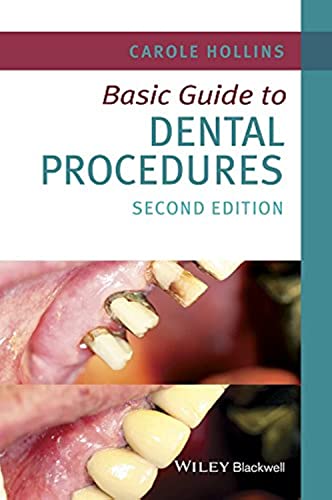 Basic Guide to Dental Procedures (Basic Guide Dentistry)