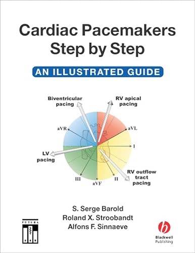 Cardiac Pacemakers Step-by-Step: An Illustrated Guide