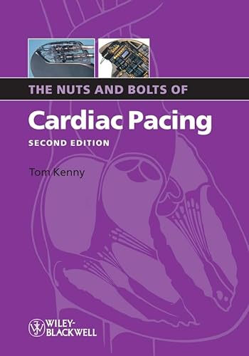 The Nuts and Bolts of Cardiac Pacing (Nuts and Bolts Series (Replaced by 5113))