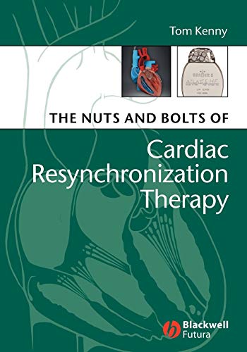 The Nuts and Bolts of Cardiac Resynchronization Therapy