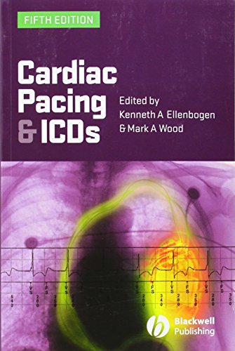 Cardiac Pacing and ICDs