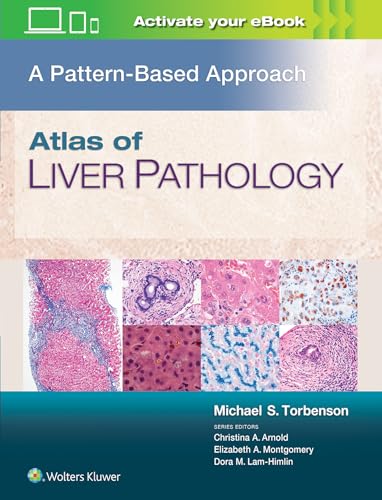 Atlas of Liver Pathology: A Pattern-Based Approach