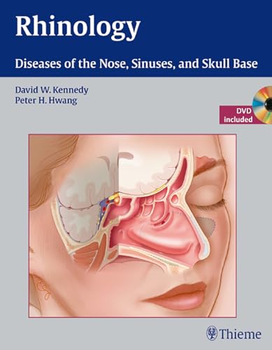 Rhinology: Diseases of the Nose, Sinuses, and Skull Base