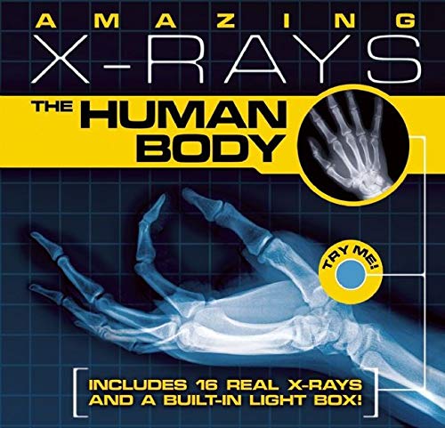 The Human Body (Amazing X-rays)