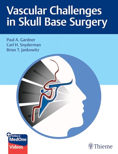 Vascular Challenges in Skull Base Surgery