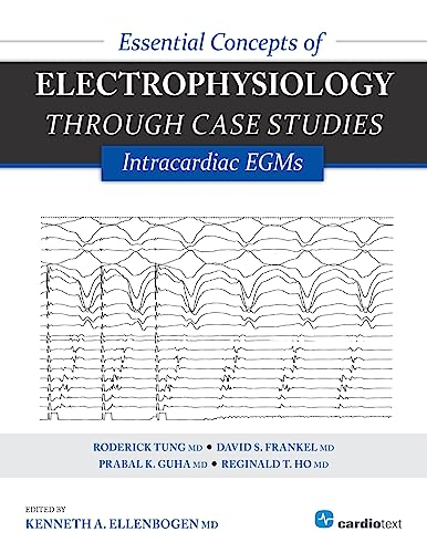 Essential Concepts of Electrophysiology through Case Studies: Intracardiac EGMs