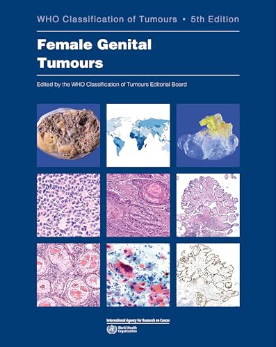 Female Genital Tumours: WHO Classification of Tumours (Medicine)