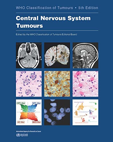 Central Nervous System Tumours: WHO Classification of Tumours