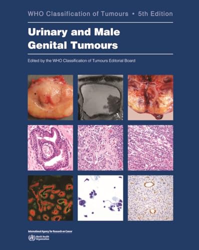 Urinary and Male Genital Tumours (WHO Classification of Tumours, 8)